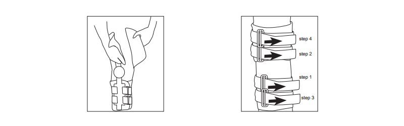 Instruction For Use The Medical Post OP Knee Braces